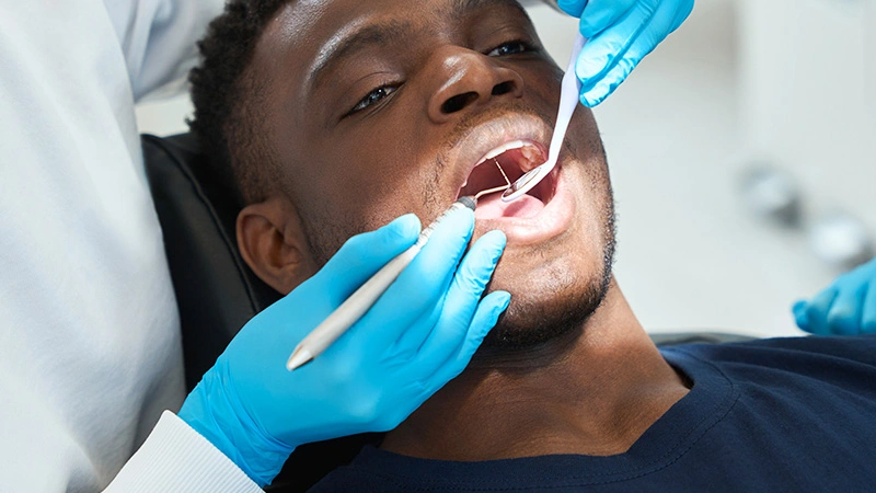 Full-mouth fast prep